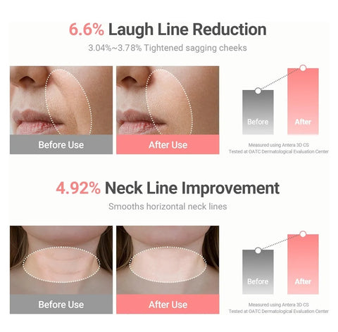 KAHI Wrinkle Bounce Multi Balm Stick | PDRN Collagen Wrinkle Stick | Korean Skin Care |All-in-One Hydrating Lip Balm Eye Cream Neck Cream Make Up Base & Face Mist Moisture Balm